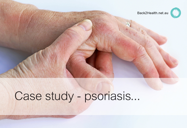 One woman’s life-long battle with psoriasis and eczema